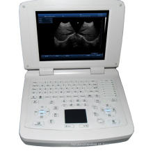 Scanner de ultrassom para laptop totalmente digital